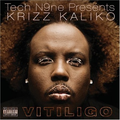 Krizz Kaliko – Vitiligo (CD) (2008) (FLAC + 320 kbps)